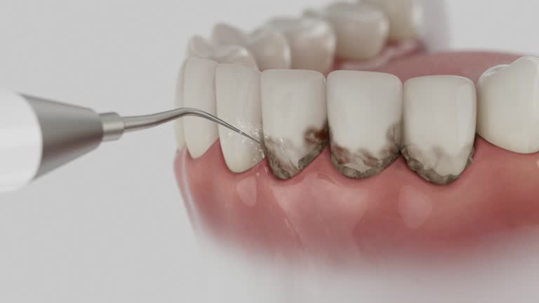 Trusted Wisdom Tooth Removal service in Little Rock, AR - Dentist Open Now